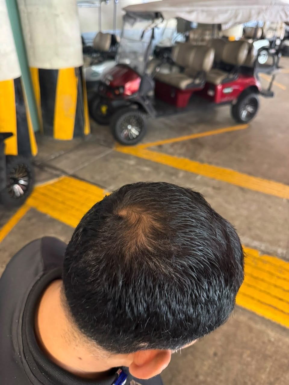 Cliente A, después del uso: vista desde arriba de la cabeza