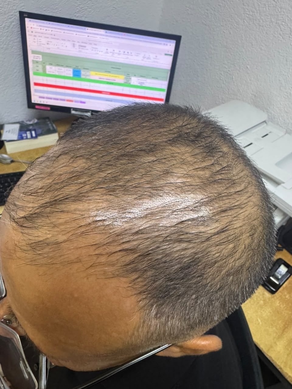Cliente B, antes del uso: vista desde arriba y atrás de la cabeza