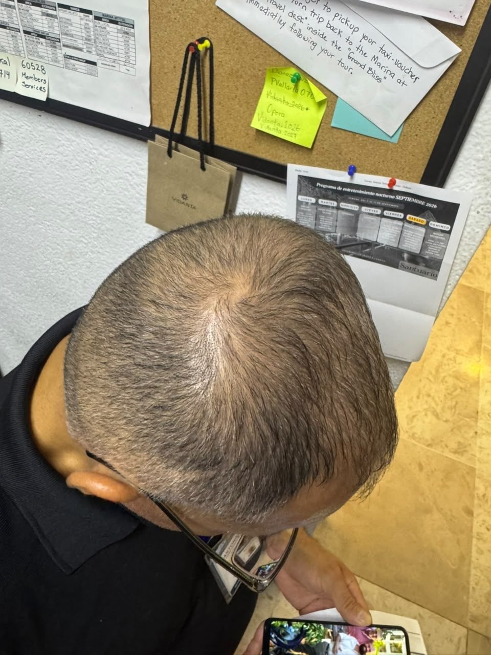 Cliente B, después del uso: vista desde arriba y atrás de la cabeza